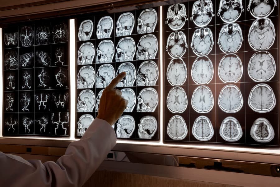 When to See a Neurosurgeon