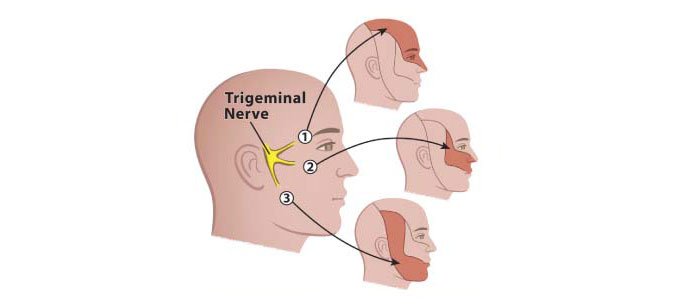 Exercises to Relieve Trigeminal Neuralgia